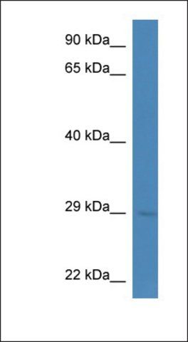 Anti-ELA1 antibody produced in rabbit