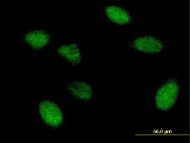 Anti-EIF5A2 antibody produced in mouse