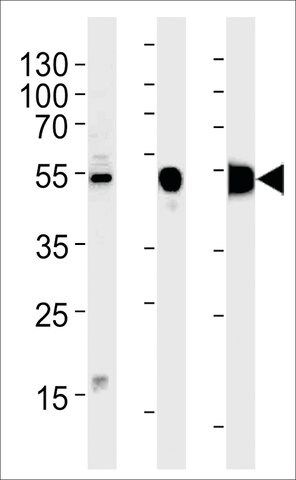 ANTI-ENOB (CENTER) antibody produced in rabbit