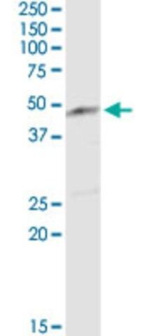 Anti-ENO3 antibody produced in rabbit