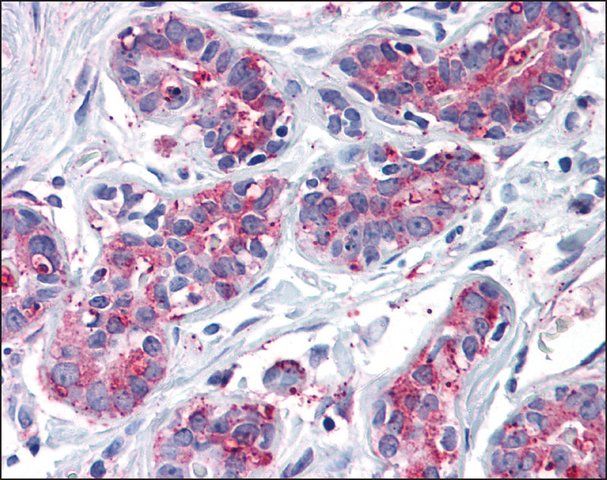 Anti-ENTPD2 antibody produced in rabbit