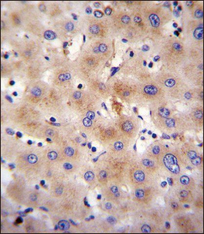 ANTI-FBXO47 (N-TERM) antibody produced in rabbit