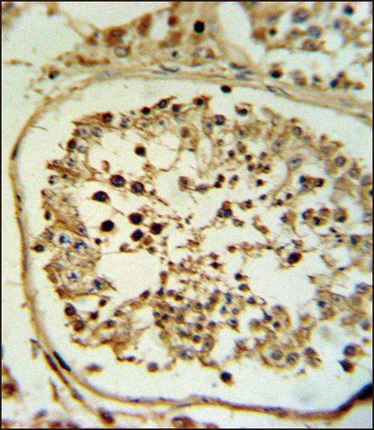 ANTI-FASCIN-3 (N-TERM) antibody produced in rabbit