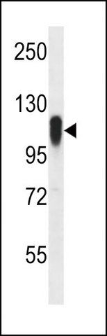 ANTI-FBX41 (N-TERM) antibody produced in rabbit