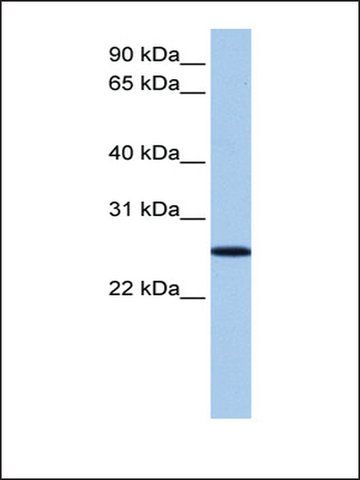 Anti-FBXO36 antibody produced in rabbit