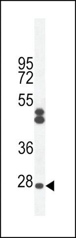 ANTI-CF062 (CENTER) antibody produced in rabbit