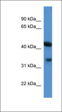 Anti-CENTA1 antibody produced in rabbit