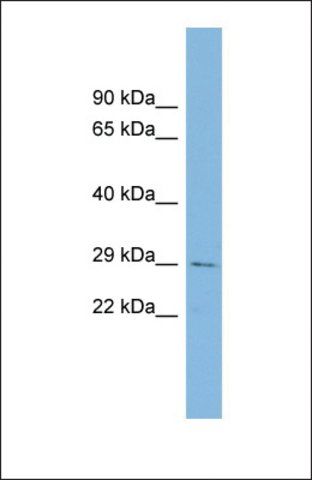 Anti-CHCHD3 antibody produced in rabbit