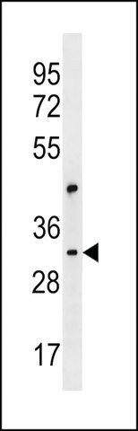 ANTI-CEP170L (CENTER) antibody produced in rabbit