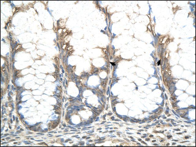 Anti-CHIC2 antibody produced in rabbit