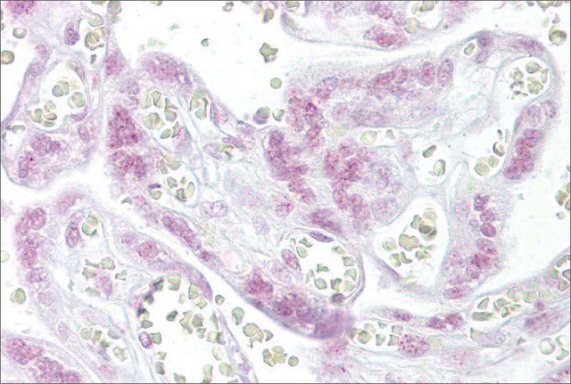 Anti-CHEK2 antibody produced in rabbit