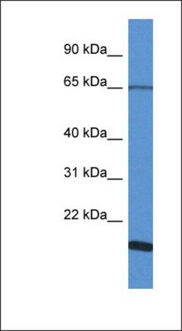 Anti-CHRNA6 antibody produced in rabbit