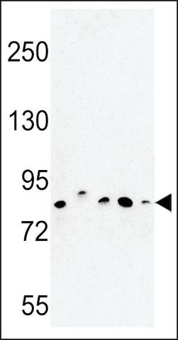ANTI-CHPF (CENTER) antibody produced in rabbit