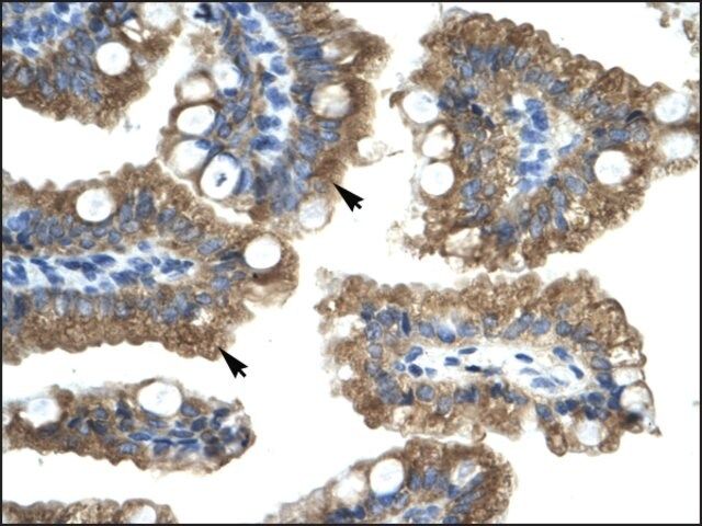 Anti-CHRNA1 antibody produced in rabbit