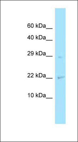 Anti-CHMP2A antibody produced in rabbit