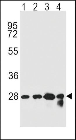 ANTI-CHPT1 (N-TERM) antibody produced in rabbit