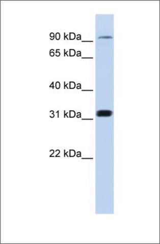 Anti-CNNM4 antibody produced in rabbit