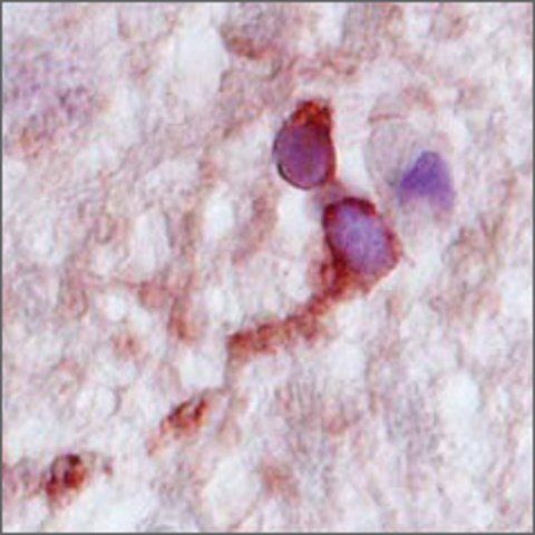 Anti-CPLX2, (N-terminal) antibody produced in rabbit