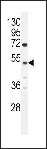 ANTI-CPA6 (CENTER) antibody produced in rabbit