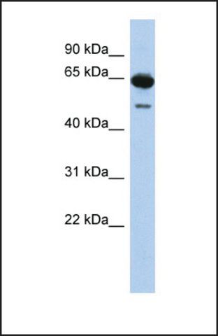 Anti-DAZ1, (N-terminal) antibody produced in rabbit