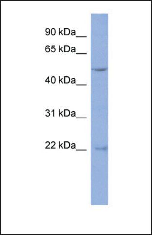 Anti-DAZ3 antibody produced in rabbit