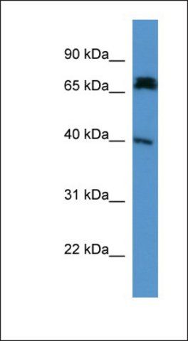 Anti-DCDC2A antibody produced in rabbit