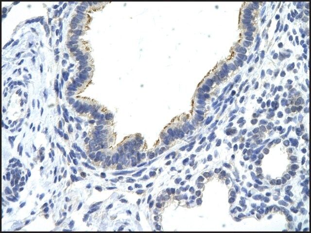 Anti-DDX21 (AB1) antibody produced in rabbit