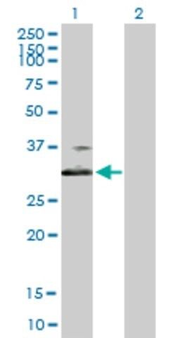 Anti-BDKRB1 antibody produced in mouse