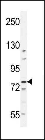 ANTI-BCL11B (CENTER) antibody produced in rabbit