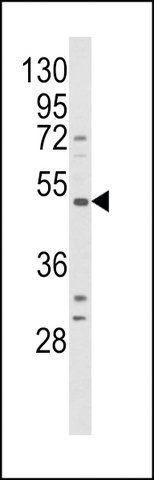 ANTI-BDK_1 (CENTER) antibody produced in rabbit