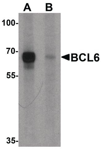 Anti-BCL6 antibody produced in rabbit