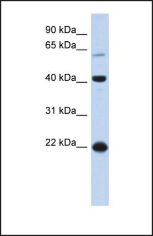 Anti-BLZF1, (N-terminal) antibody produced in rabbit