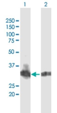 Anti-B3GNT4 antibody produced in mouse