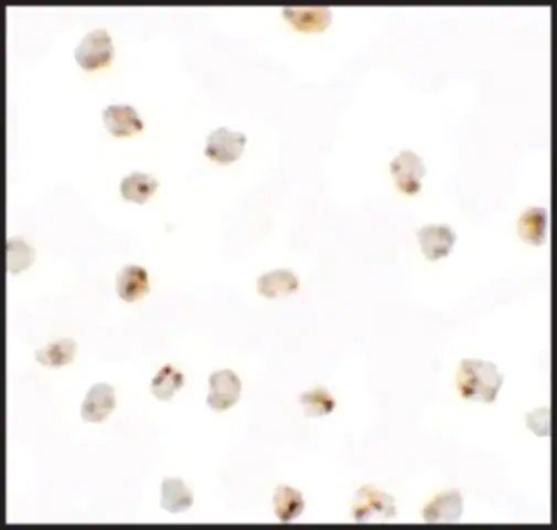 Anti-BMP15 antibody produced in rabbit