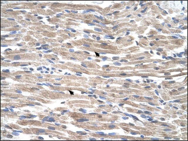 Anti-BMP2K antibody produced in rabbit
