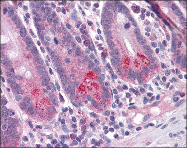 Anti-BIRC6 antibody produced in rabbit