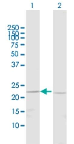 Anti-BNIP1 antibody produced in rabbit