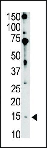 ANTI-BIK BH3 DOMAIN antibody produced in rabbit