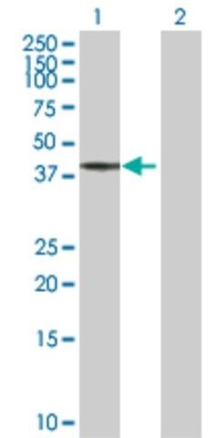 Anti-BCS1L antibody produced in rabbit