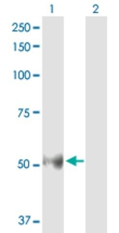 Anti-BMP5 antibody produced in rabbit