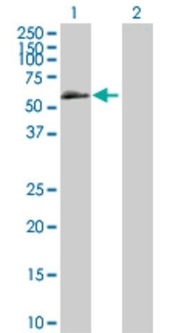 Anti-BMPR1B antibody produced in mouse