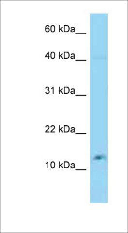 Anti-C10ORF132 antibody produced in rabbit