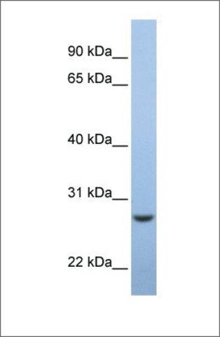 Anti-C15ORF24 antibody produced in rabbit