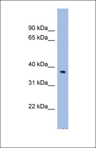 Anti-C17ORF48, (N-terminal) antibody produced in rabbit