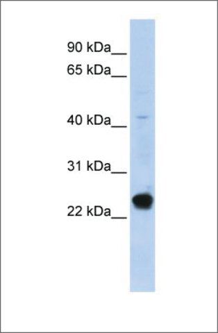 Anti-C16ORF80 antibody produced in rabbit