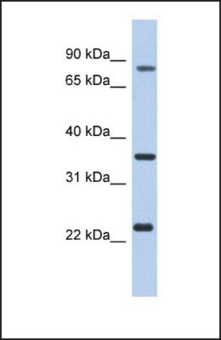 Anti-C17ORF82, (N-terminal) antibody produced in rabbit