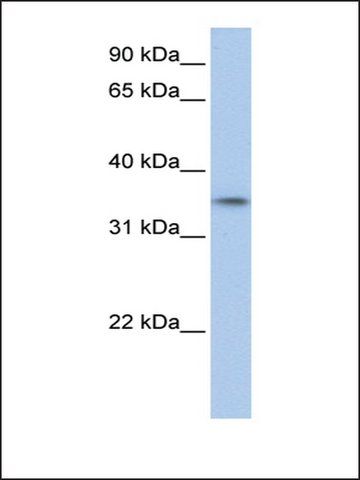 Anti-C17ORF39 (AB2) antibody produced in rabbit