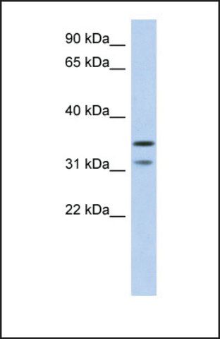 Anti-C17ORF81 antibody produced in rabbit