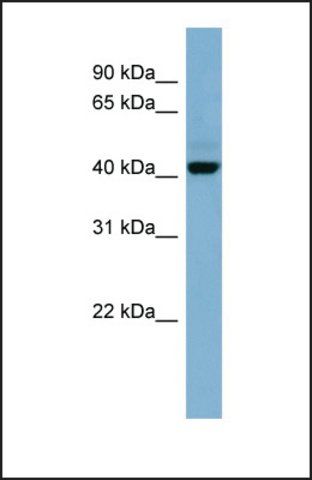 Anti-C1ORF102, (N-terminal) antibody produced in rabbit