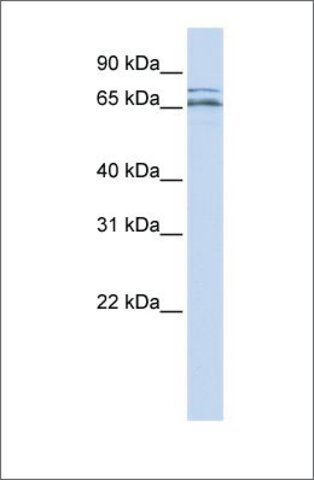 Anti-CACNB2 (ab2) antibody produced in rabbit